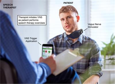 Vagus Nerve Stimulation as a Potential Adjuvant to Rehabilitation for Post-stroke Motor Speech Disorders